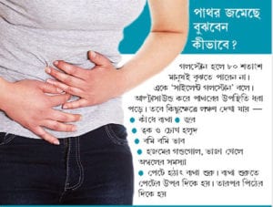 gallbladder1_web