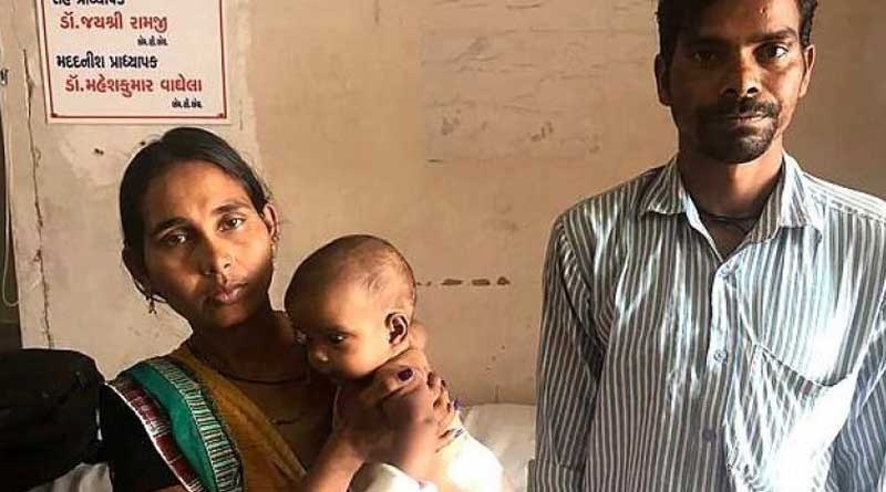 Gujarat baby born with four limbs successfully operated on  