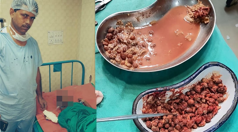  Doctors remove 203 berry seeds from toddlers stomach