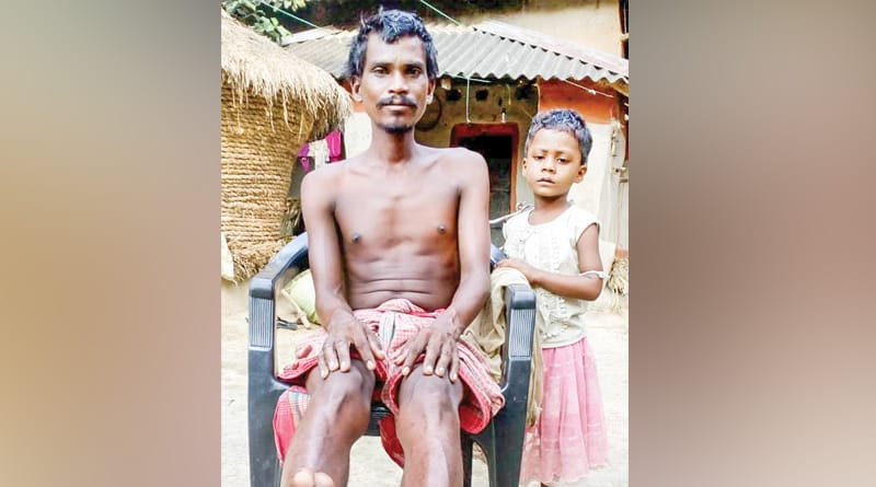 Katwa: Leprosy patient name excluded from Govt housing plan