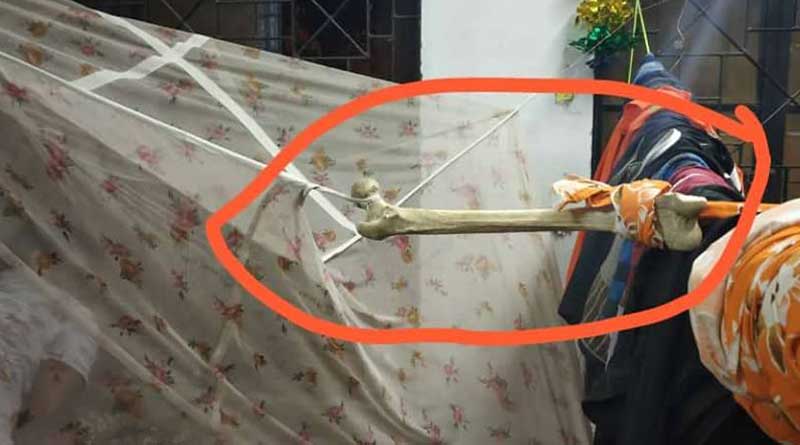 Human remains 'desecrated' in Burdwan Medical College  