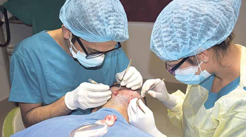 Man died 2 days after getting hair transplant