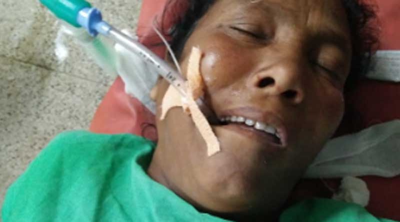 Bone stuck into the throat of a women