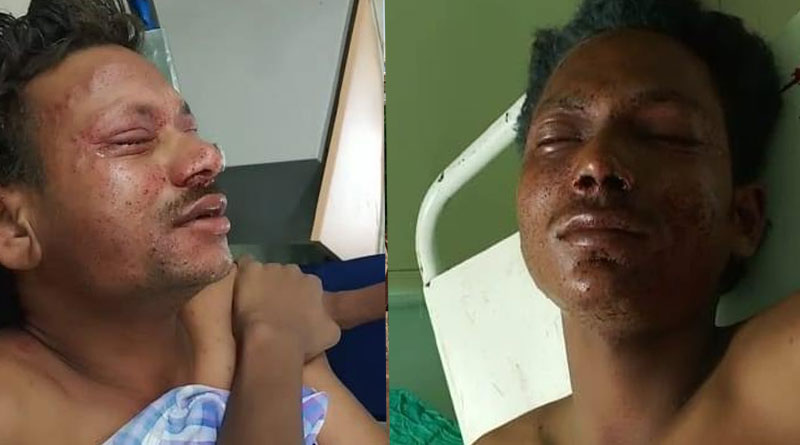 Three alleged BJP workers injured in Itahar bomb blast