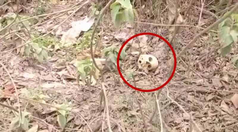 Human skeletal remains found behind SKMC Hospital