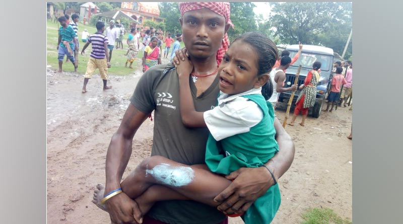 6-years-old child injured in bombing in West Midnapore