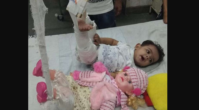 To treat a baby doctor first had to plaster her favourite doll