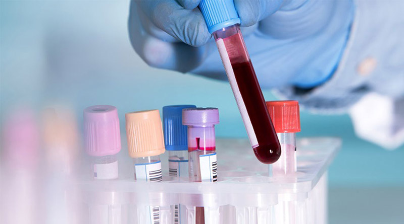Corona survivers in West Bengal wish to donate blood for plasma therapy