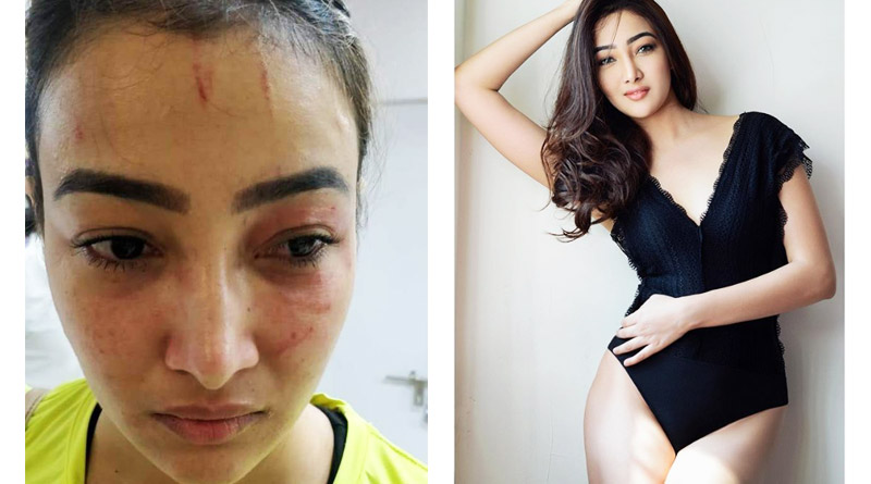 Television actress Nalini Negi lodged FIR against her roommate