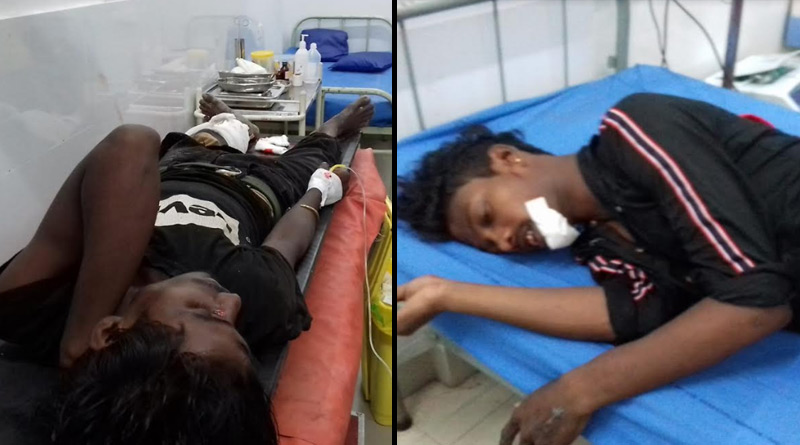 2 accident in Malbazar on Sunday night, injured four