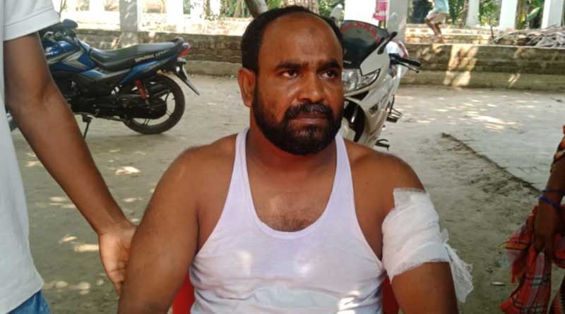 Tmc worker attacked by someone with sharp cutting weapon in Bhangar