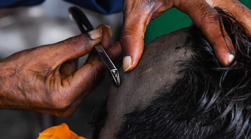 Man Shaves Wife's Head After Finding Hair In Food