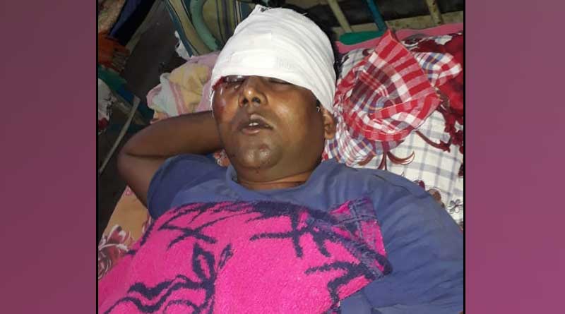 A TMC worker allegedly beaten up by BJP goons in Alipurduar