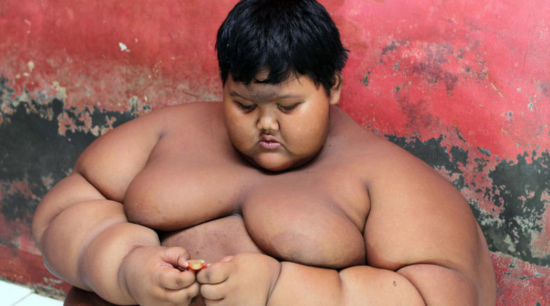 Weight loss: Indonesian kid losses 87 Kg in four years
