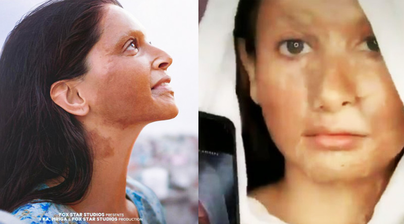 Netizens trolled Deepika for Tiktok challenge in Chhapaak look