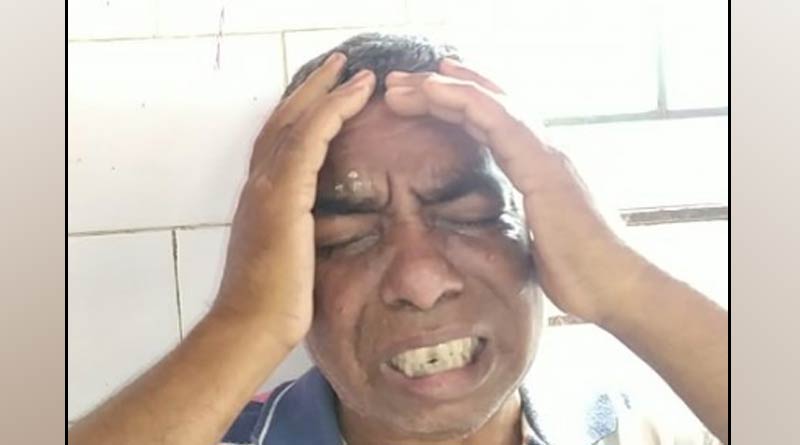 A man attcked by his wife in North 24 pargana's taki area