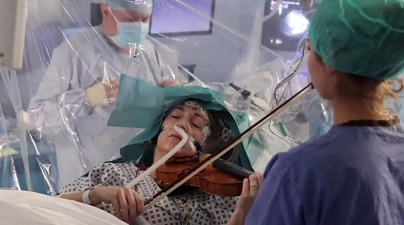 Patient play violin during brain tumor operation, viral video
