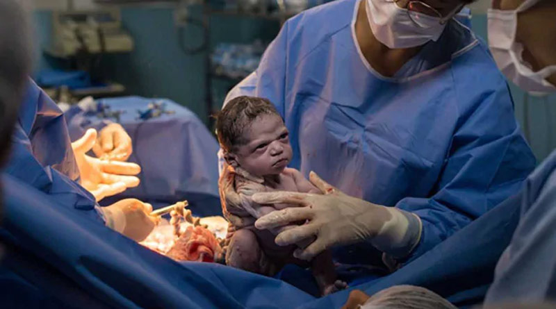 Brazilian baby goes viral for epic scowl moments after birth