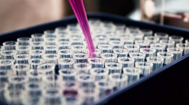 Pool testing starts in West Bengal to find COVID-19 carrier