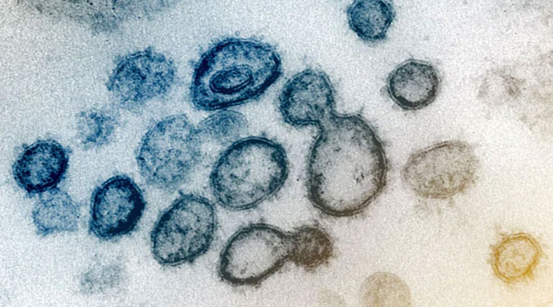 New outbreak in China North-east region,virus changing unknown way