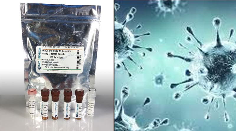WHO is asking for Corona Virus test kit made in West Bengal