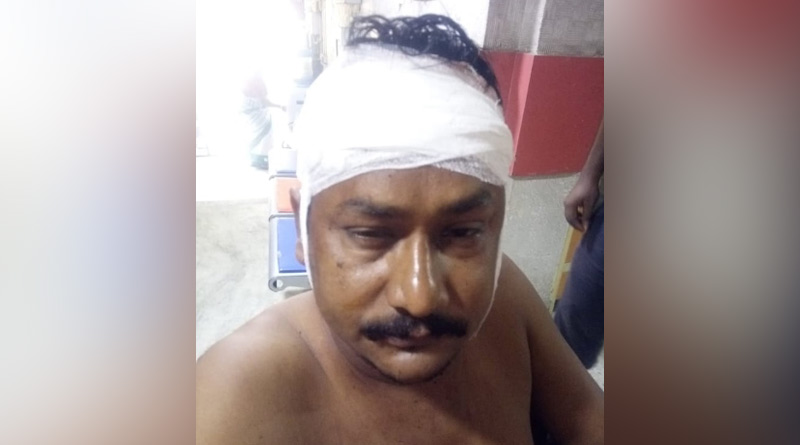 Trinamool Congress leader attacked in South 24 Pargana's Pujali