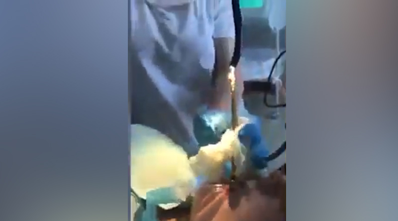 ‘Worst nightmare’: 4-feet snake pulled out from woman’s mouth in Russia