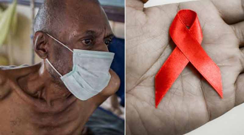 At the same time, the number of TB and AIDS cases is increasing, said health department | Sangbad Pratidin