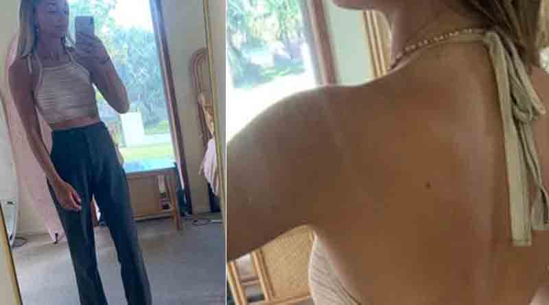 Woman asked to change top showing 'too much skin' before boarding flight | Sangbad Pratidin
