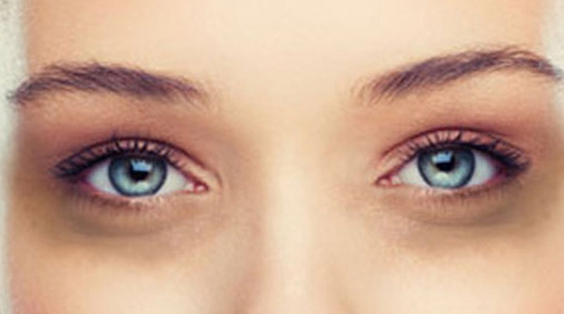 Vitamin C is good for dark circles under the eyes | Sangbad Pratidin