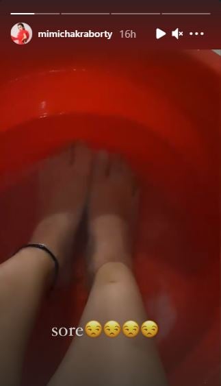 Mimi Chakraborty shares sored leg's picture on Instagram Story