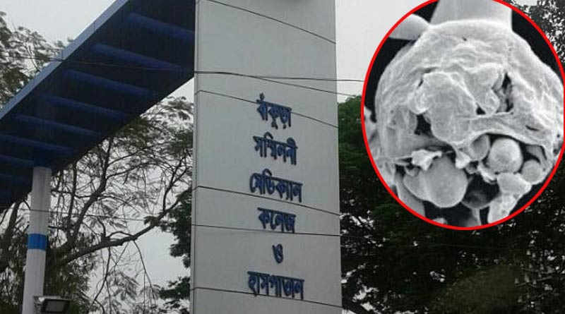 Black fungus: 3 corona patients detected with the desease in Bankura | Sangbad Pratidin