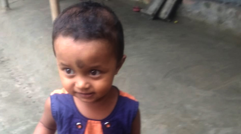 SSKM Hospital doctors perform life saving surgery on Assam kid | Sangbad Pratidin