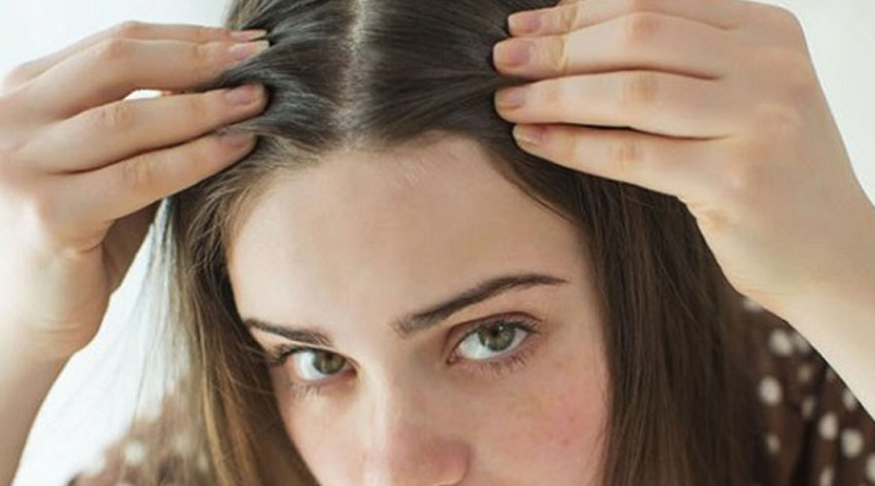 Natural Remedies To Reduce Gray Hair | Sangbad Pratidin