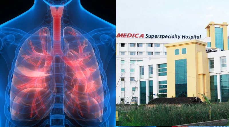 Lung transplant fails, recipient dies at Kolkata hospital । Sangbad Pratidin