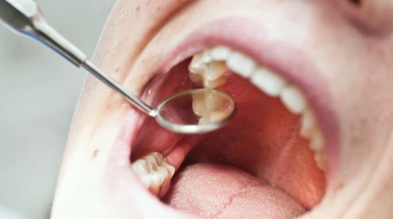 Private hospital charges 7K for removing one tooth in Kolkata | Sangbad Pratidin