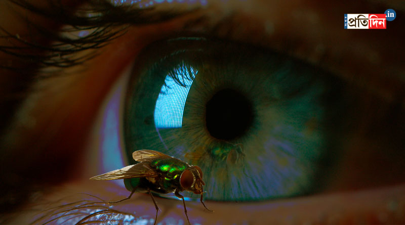 Delhi Hospital Removed Live Botflies from an American Woman's Eye | Sangbad Pratidin