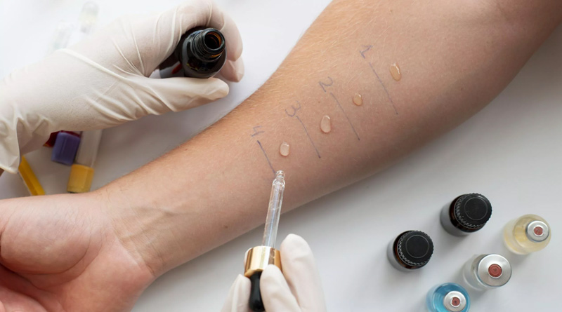 Allergy test