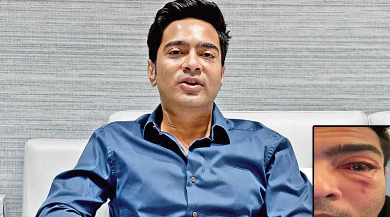 Abhishek Banerjee undergoes eye surgery in America, Kunal Ghosh posts pics । Sangbad Pratidin