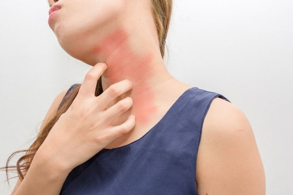 Allergy-2