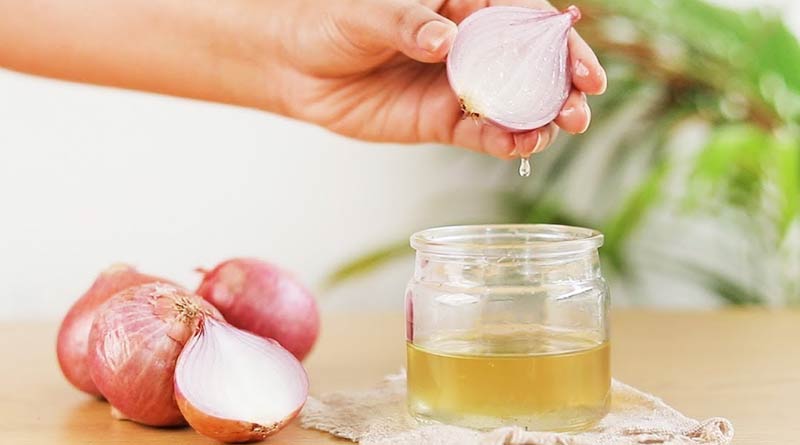 Here are some important fact about onion oil । Sangbad Pratidin