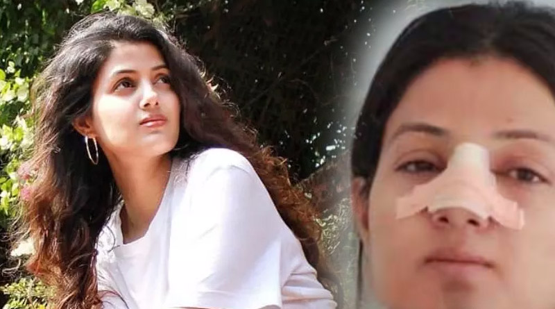 Sumati Singh opens up about her nose job | Sangbad Pratidin