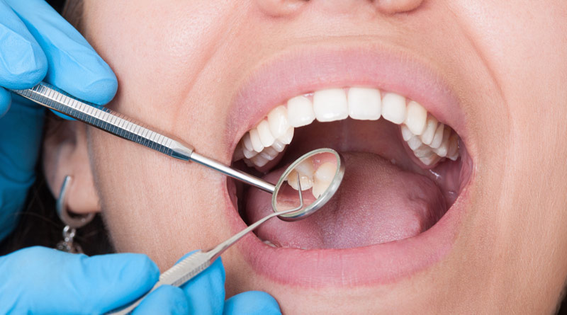 Know about Oral Hygiene and Oral Cancer | Sangbad Pratidin