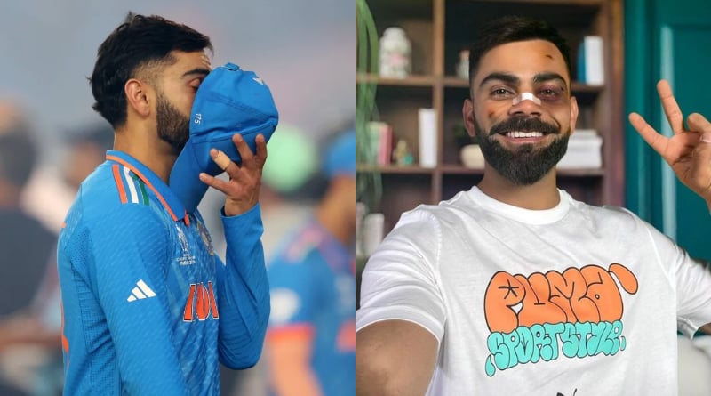 Virat Kohli posts picture with bruises and black eye, find out why। Sangbad Pratidin