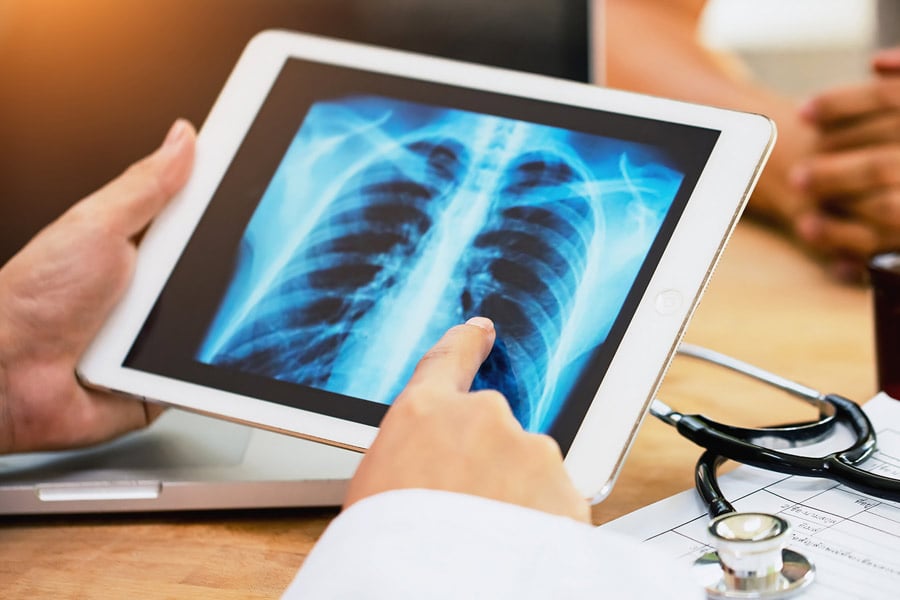Health tips about Pulmonary Cysts, know causes and treatments | Sangbad Pratidin