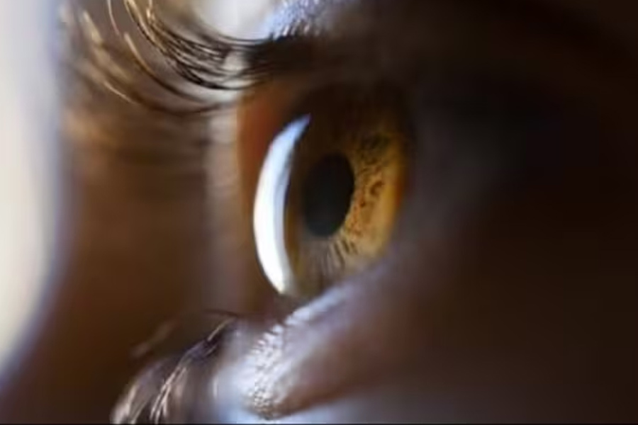 Know about Wet age-related macular degeneration (AMD), Expert gave Health Tips