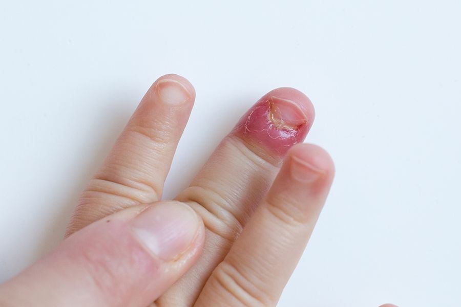 Nail-2