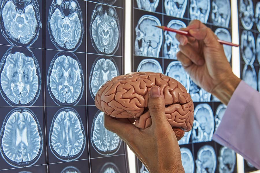 Brain-1