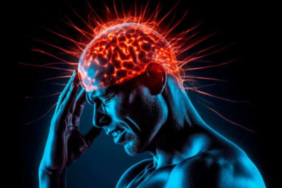 Brain-2