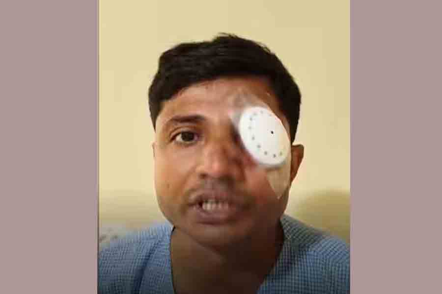 Police injured in Nabanna Abhiyaan will get treatment in Hyderabad